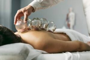 cupping therapy in singapore